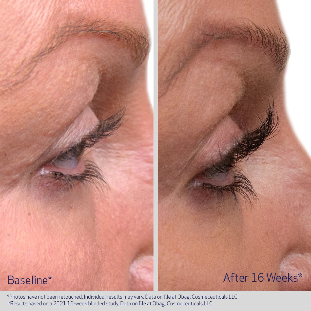 OBAGI EYELASH ENHANCING SERUM