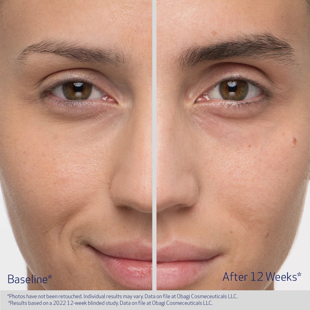 OBAGI EYEBROW BOOSTING SERUM