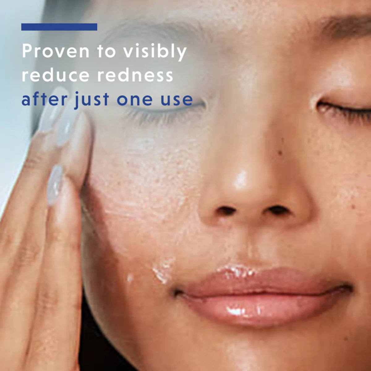 EltaMD Skin Recovery Serum